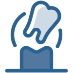 Implantes Dentários